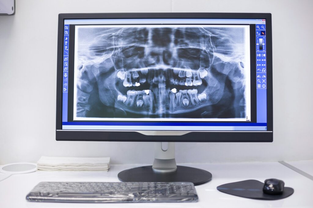 An x-ray on the monitor